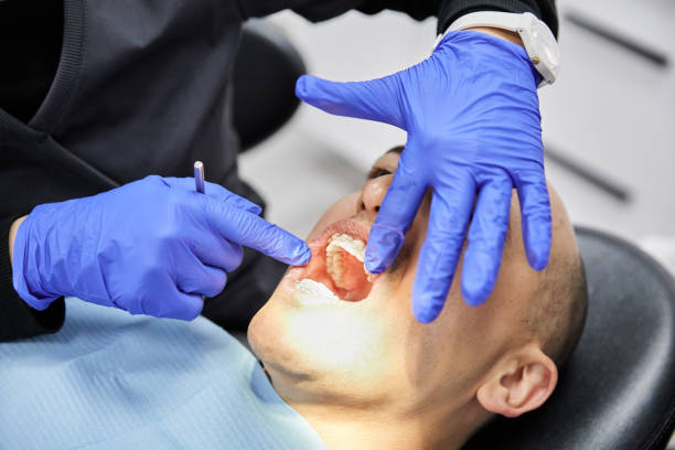 Best Emergency Dentist for Knocked-Out Tooth in Seabrook Farms, NJ
