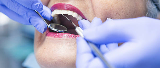 Best Emergency Dentist for Knocked-Out Tooth in Seabrook Farms, NJ